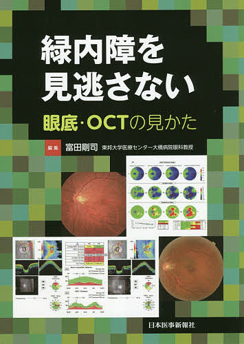 白内障手術ロジカルテクニック 柴宏治／著 眼科学の本 - 最安値・価格