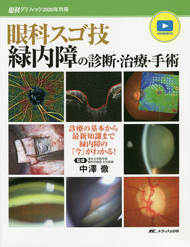 眼科スゴ技緑内障の診断・治療・手術　診療の基本から最新知識まで緑内障の「今」がわかる！　ＷＥＢ動画付き （眼科グラフィック　２０２０年別冊） 中澤徹／監修の商品画像