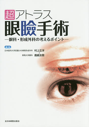 超アトラス眼瞼手術　眼科・形成外科の考えるポイント 村上正洋／編集　鹿嶋友敬／編集の商品画像