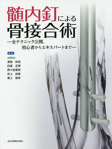 髄内釘による骨接合術 全テクニック公開、初心者からエキスパートまで 髄内釘による骨接合術 ー全テクニック公開、初心者からエキスパート