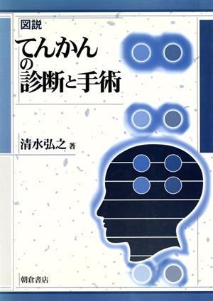 図説てんかんの診断と手術 清水弘之／著の商品画像