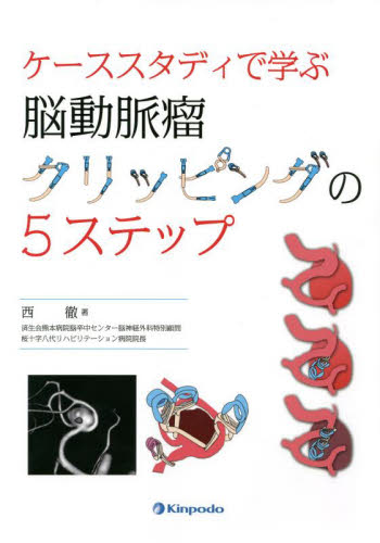 多発性硬化症の診断と治療 吉良潤一／編集 脳神経外科学の本 - 最安値