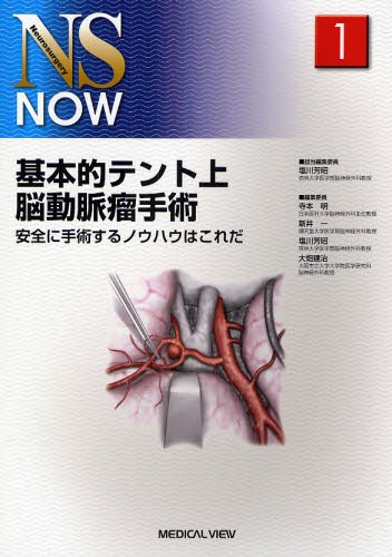 パーフェクトマスター頚動脈狭窄症 永田泉／監修 中原一郎／編集