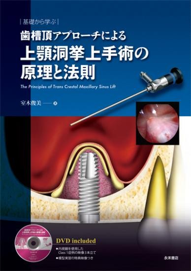 歯槽頂アプローチによる上顎洞挙上手術の原理と法則　基礎から学ぶ 室木俊美／著の商品画像