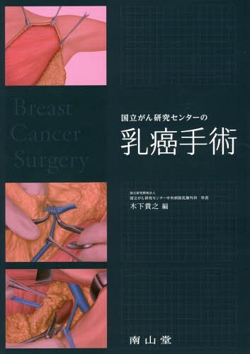 国立がん研究センターの乳癌手術 木下貴之／編の商品画像