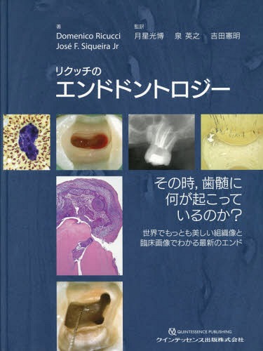 リクッチのエンドドントロジー その時，歯髄に何が起こっている