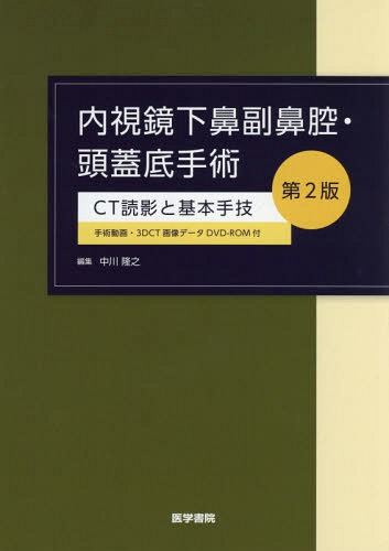 内視鏡下鼻副鼻腔・頭蓋底手術　ＣＴ読影と基本手技 （第２版） 中川隆之／編集　中川隆之／〔ほか〕執筆の商品画像