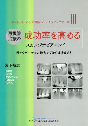 再根管治療の成功率を高めるスカンジナビアエンド　ガッタパーチャの除去で７０％は決まる！ （エンド・ペリオ日常臨床のレベルアップコース　３） 宮下裕志／著の商品画像