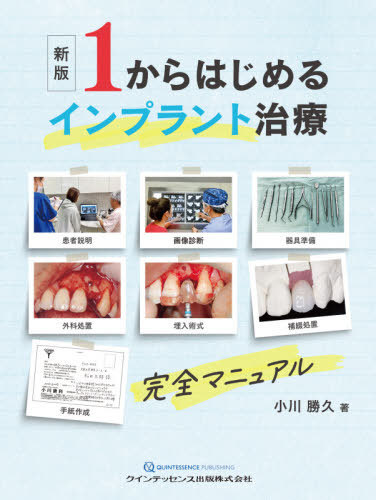 １からはじめるインプラント治療完全マニュアル （新版） 小川勝久／著の商品画像