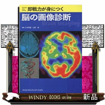 腹部血管画像解剖アトラス 衣袋健司／著 画像診断、超音波診断学の本