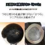 天頂部の毛量が少ない部分かつら