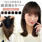 部分ウィッグ 頭頂部 ウィッグ ヘアピース 女性 トップカバー トップピース かつら 医療用 ウイッグ 自然 つむじ 白髪隠し 薄毛 プリン ミディアム 前髪ウィッグ