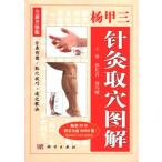 [ китайский язык упрощенные иероглифы ].. три игла прижигание брать дыра иллюстрация ( все новый . класс версия )