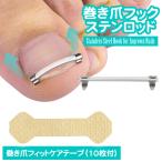 巻き爪 フックステンロッド まきづめ クリップ ネイルケア 形状記憶 陥入爪 巻爪ケア 矯正 巻き爪矯正 巻きづめ 足の巻き爪 防止 巻き爪ケア