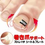  наматывать коготь корректирующий наматывать коготь лента .... подъёмник .... наматывать коготь блок наматывать коготь корректирующий наклейка наматывать коготь уход шт коготь терапия наматывать коготь корректирующий бесплатная доставка 