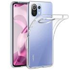 Xiaomi Mi 11 Lite 5G ケース クリア 耐衝撃 薄型 柔軟 全面保護 軍用規格ストラップホール シャオミ