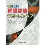 網膜診療クローズアップ / 柳靖雄