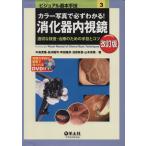 カラー写真で必ずわかる！消化器内視鏡 改訂版 適切な検査・治療のための手技とコツ ビジュアル基本手技3/中島