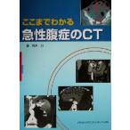 ko волчок . понимать внезапный .... CT/. дерево сила ( автор )