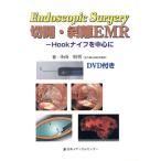  разрез * отшелушивание EMR Hook нож . центр ./ Ояма . мужчина ( автор )