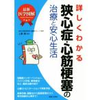 詳しくわかる狭心症・心筋梗塞の治療と安心生活 最新医学図解/上妻謙