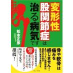変形性股関節症は治る病気です/松本正彦(著者)