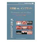 天然歯ｖｓ．インプラント / 上田秀朗／監修　夏堀礼二／編集　船登彰芳／編集　石川知弘／編集　水上哲也／編集　石井肖得／〔ほか〕著