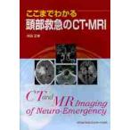 ko волчок . понимать голова первая помощь. CT*MRI /. рисовое поле правильный . работа 