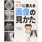 ケアに使える画像の見かた: X線写真・CT画像・エコ-像・MRI 久志本 成樹