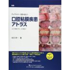 新版 チェアサイド・介護で役立つ 口腔粘膜疾患アトラス