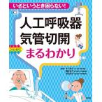 人工呼吸器・気管切開まるわかり