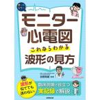 モニター心電図 これならわかる波形の見方