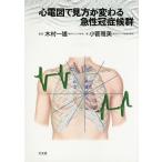  сердце электро- map . точка зрения . меняется внезапный .... группа / дерево . один самец / маленький . Масами 