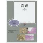 胃癌/深山正久/大倉康男/腫瘍病理鑑別診断アトラス刊行委員会