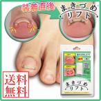 正規品 まきづめリフト (メール便送料無料) 巻き爪ケア ネイル つめ ワイヤー 巻き爪 矯正