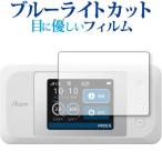 Aterm MR10LN специальный голубой свет cut отражающий предотвращение защитная плёнка отпечаток пальца предотвращение почтовая доставка бесплатная доставка сменный товар 