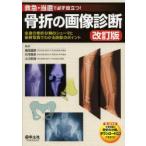 新品本/骨折の画像診断　救急・当直で必ず役立つ!　全身の骨折分類のシェーマと症例写真でわかる読影のポイント　福田国彦/編集　丸毛啓史/編集　小川武希/編集