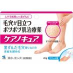 その他皮膚の薬