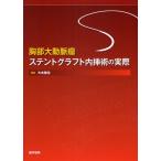 胸部大動脈瘤ステントグラフト内挿術の実際