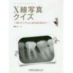 X線写真クイズ 1枚のデンタルから何を読み取るか?