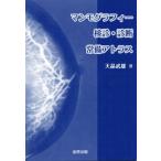 マンモグラフィー検診・診断 常備アトラス