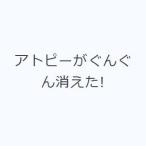 アトピーがぐんぐん消えた!
