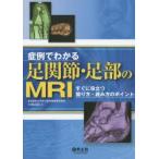 症例でわかる足関節・足部のMRI すぐに役立つ撮り方・読み方のポイント