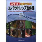 スリット所見で診るコンタクトレンズ合併症