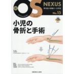 小児の骨折と手術