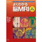 よくわかる脳MRI