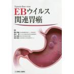 EBウイルス関連胃癌