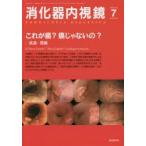 消化器内視鏡 Vol.26No.7（2014July）
