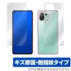 ショッピングmi 11 lite 5g Xiaomi Mi 11 Lite 5G 表面 背面 フィルム OverLay Magic for シャオミー Mi11 ライト キズ修復 耐指紋 防指紋 コーティング シャオミーミーイレブンライト 爆買
