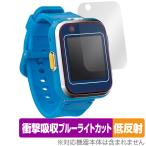  Doraemon .... смарт-часы защитная плёнка OverLay Absorber низкий отражающий смарт-часы игрушка ударная абсорбция отражающий предотвращение антибактериальный . покупка 